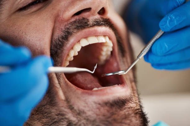 Best Emergency Denture Repair in Clayco, MO
