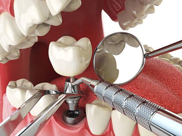 Best Emergency Gum Treatment in Clayco, MO